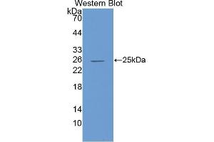 Detection of recombinant IL6 using Polyclonal Antibody to Interleukin 6 (IL6) (IL-6 antibody  (AA 27-212))