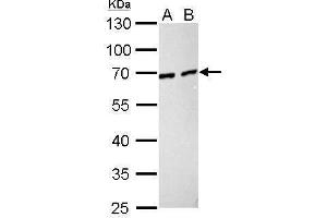 WB Image Nucleoporin p62 antibody detects NUP62 protein by Western blot analysis. (NUP62 antibody)