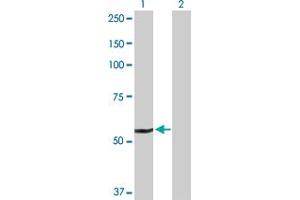 Western Blot analysis of DHCR24 expression in transfected 293T cell line by DHCR24 MaxPab polyclonal antibody. (Seladin 1 antibody  (AA 1-516))