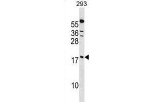 Western Blotting (WB) image for anti-Peptidylprolyl Isomerase (Cyclophilin)-Like 1 (PPIL1) antibody (ABIN2998971) (PPIL1 antibody)