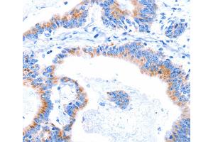 Immunohistochemistry (IHC) image for anti-Smg-8 Homolog, Nonsense Mediated mRNA Decay Factor (SMG8) antibody (ABIN2426641) (SMG8 antibody)