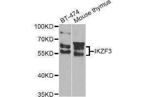 Western blot analysis of extracts of various cell lines, using IKZF3 Antibody. (IKZF3 antibody)