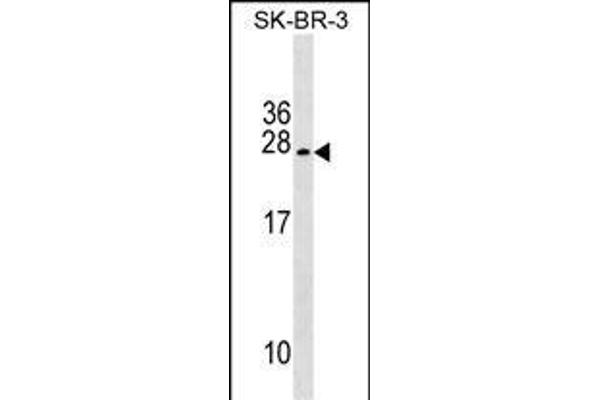 TUSC5 antibody  (AA 78-104)