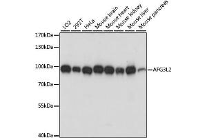 Western blot analysis of extracts of various cell lines, using L2 antibody (ABIN7265513) at 1:1000 dilution. (AFG3L2 antibody  (AA 538-797))