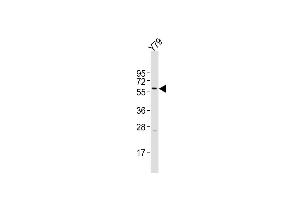 Western Blotting (WB) image for anti-Keratin 12 (KRT12) (AA 442-471), (C-Term) antibody (ABIN656663)