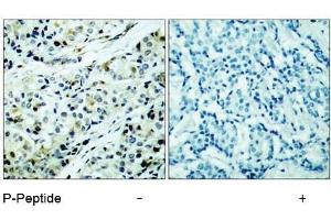 Image no. 1 for anti-Histone Deacetylase 5 (HDAC5) (pSer498) antibody (ABIN196933) (HDAC5 antibody  (pSer498))