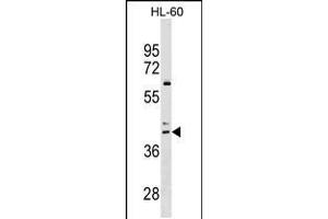 Western blot analysis in HL-60 cell line lysates (35ug/lane). (CCR4 antibody  (C-Term))