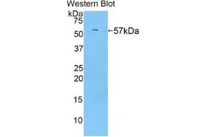 Western blot analysis of the recombinant protein. (TGM1 antibody  (AA 433-692))