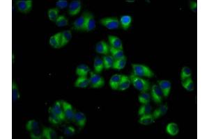 Immunofluorescence staining of Hela cells with ABIN7164887 at 1:66, counter-stained with DAPI. (PTOV1 antibody  (AA 2-137))