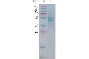 Human C-Nanodisc, Flag Tag on SDS-PAGE (CXCR1 Protein)
