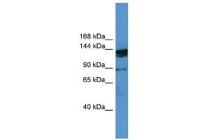 WB Suggested Anti-OGDHL Antibody Titration: 0. (OGDHL antibody  (N-Term))