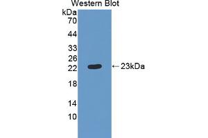 Western blot analysis of the recombinant protein. (CMTM8 antibody  (AA 1-173))