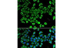 Immunofluorescence analysis of A-549 cells using LCN2 Polyclonal Antibody (Lipocalin 2 antibody)