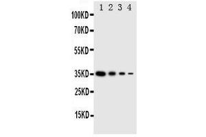 Western Blotting (WB) image for anti-Eukaryotic Translation Initiation Factor 2 alpha Kinase 4 (EIF2AK4) (AA 868-886), (Middle Region) antibody (ABIN3044057) (GCN2 antibody  (Middle Region))