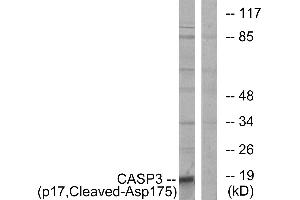 Western blot analysis of extracts from COLO cells, using CASP3 (p17, Cleaved-Asp175) antibody. (Caspase 3 antibody  (Cleaved-Asp175, Subunit p17))