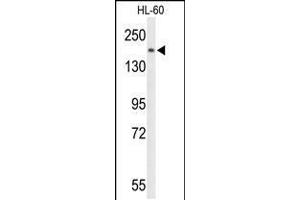 Western blot analysis of PLCB1 Antibody in HL-60 cell line lysates (35ug/lane) (Phospholipase C beta 1 antibody  (C-Term))