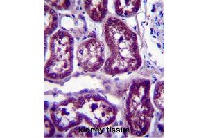 Immunohistochemistry (IHC) image for anti-Dihydropyrimidinase (DPYS) antibody (ABIN2997327) (DPYS antibody)