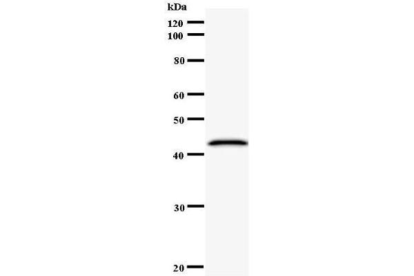 CNOT6 antibody