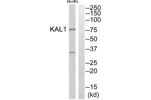 Western Blotting (WB) image for anti-Kallmann Syndrome 1 Sequence (KAL1) (Internal Region) antibody (ABIN1850777) (KAL1 antibody  (Internal Region))