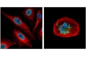 ICC/IF Image Confocal immunofluorescence analysis (Olympus FV10i) of paraformaldehyde-fixed U2OS, using CDCA1, antibody (Geen) at 1:500 dilution. (NUF2 antibody)