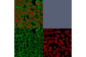 Confocal immunofluorescence image of HeLa cells using Fascin-1 Mouse Monoclonal Antibody (FSCN1/416). (Fascin antibody)
