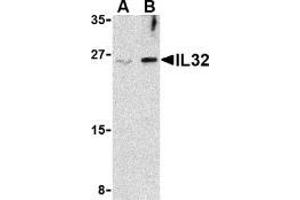 Western blot analysis of IL-32 in Jurkat cell lysate with AP30425PU-N IL-32 antibody at (A) 2. (IL32 antibody  (Intermediate Domain))