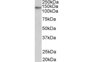 Western Blotting (WB) image for anti-Telomerase Reverse Transcriptase (TERT) (AA 597-611) antibody (ABIN1104625) (TERT antibody  (AA 597-611))