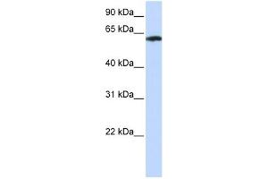 FBXO24 antibody used at 1 ug/ml to detect target protein. (FBXO24 antibody  (Middle Region))