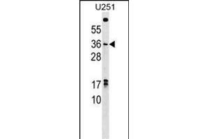 NKX3-1 Antibody (C-term) (ABIN1536752 and ABIN2848824) western blot analysis in  cell line lysates (35 μg/lane). (NKX3-1 antibody  (C-Term))