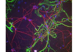 Immunofluorescence of rat cortical neurons and glia showing NF-H staining (red). (NEFH antibody)