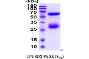 SDS-PAGE (SDS) image for Chitinase 3-Like 1 (Cartilage Glycoprotein-39) (CHI3L1) (AA 22-383) protein (His tag) (ABIN5854655) (CHI3L1 Protein (AA 22-383) (His tag))