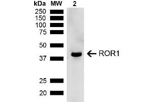 Western blot analysis of Rat Kidney showing detection of ~43 kDa ROR1 protein using Rabbit Anti-ROR1 Polyclonal Antibody (ABIN5667786). (ROR1 antibody  (AA 200-300) (Atto 594))