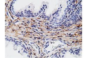 Immunohistochemistry (IHC) image for anti-CD80 (CD80) antibody (ABIN1497365) (CD80 antibody)