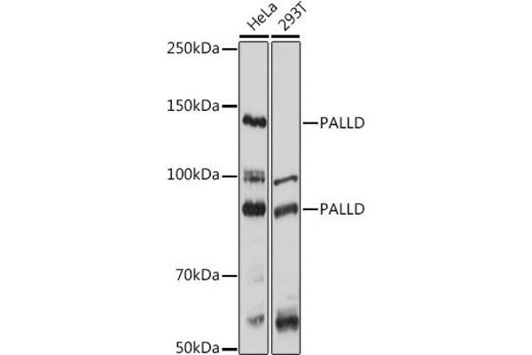 PALLD anticorps  (AA 383-672)