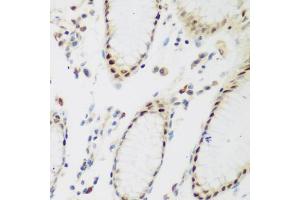 Immunohistochemistry of paraffin-embedded human stomach using PPAN antibody. (PPAN antibody)