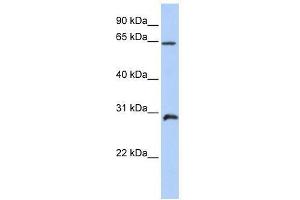 Western Blot showing HOXA5 antibody used at a concentration of 1. (HOXA5 antibody  (C-Term))