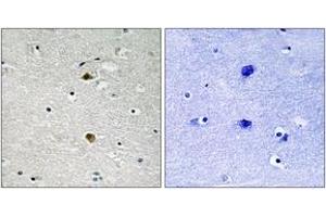 Immunohistochemistry (IHC) image for anti-Nuclear Factor-kB p65 (NFkBP65) (AA 247-296) antibody (ABIN2889092) (NF-kB p65 antibody  (AA 247-296))