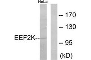 Western blot analysis of extracts from HeLa cells, treated with serum 10% 15', using eEF2K (Ab-366) Antibody. (EEF2K antibody  (AA 331-380))