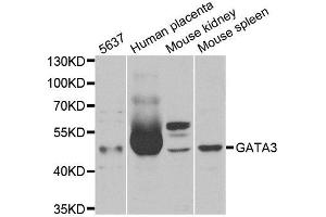 Western Blotting (WB) image for anti-GATA Binding Protein 3 (GATA3) antibody (ABIN1980147) (GATA3 antibody)