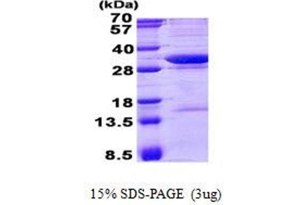 NCEH1 Protein (His tag)