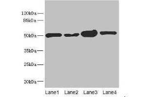 Western blot All lanes: CHN1 antibody at 6. (CHN1 antibody  (AA 1-200))