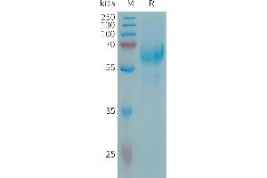 Human C Protein, His Tag on SDS-PAGE under reducing condition. (CSPG5 Protein (AA 31-420) (His tag))