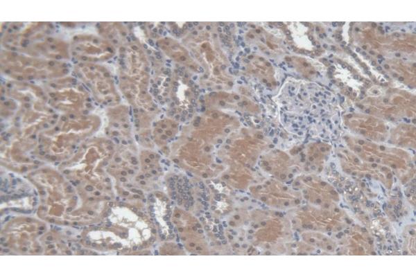 TIRAP antibody  (AA 1-221)