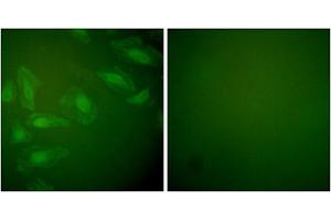 Immunofluorescence analysis of HeLa cells, using DJ-1 antibody (ABIN5976380). (PARK7/DJ1 antibody  (Internal Region))