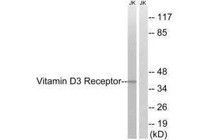 Western blot analysis of extracts from Jurkat cells, using Vitamin D3 Receptor (Ab-51) antibody. (Vitamin D Receptor antibody  (Ser51))