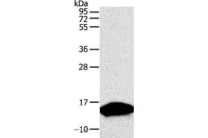 Western blot analysis of Human fetal brain tissue, using PVALB Polyclonal Antibody at dilution of 1:300 (PVALB antibody)