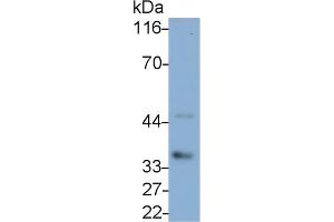 Detection of IL1b in Canine Pancreas lysate using Polyclonal Antibody to Interleukin 1 Beta (IL1b) (IL-1 beta antibody  (AA 103-260))