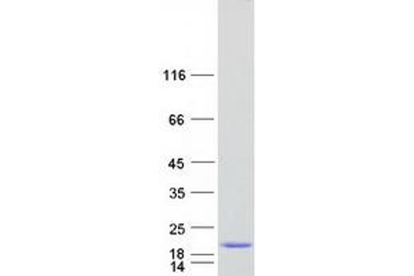 C17orf37 Protein (Myc-DYKDDDDK Tag)