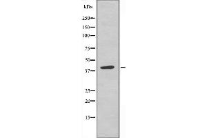 Western blot analysis of extracts from COLO205 cells, using KAPCG antibody. (PRKACG antibody)