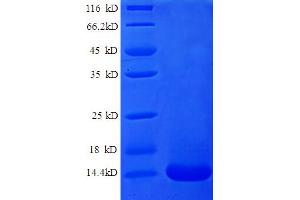 SDS-PAGE (SDS) image for Chemokine (C Motif) Ligand 1 (XCL1) (AA 22-114) protein (His tag) (ABIN5712692) (XCL1 Protein (AA 22-114) (His tag))